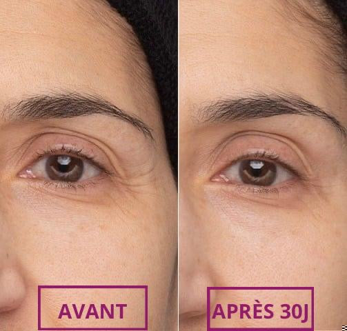 Dr. Melaxin : Beaume hydratant, nourrissant pour le contour des yeux